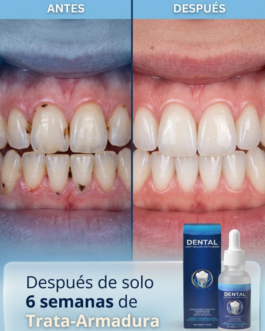 Armadura Dental Curativa