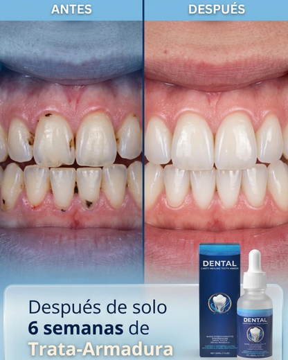 Armadura Dental Curativa